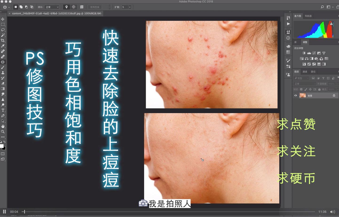 ps修补替换工具结合色相饱和度 完美去除面部红痘(附素材) ps修补替换工具结合色相饱和度 完美去除面部红痘(附素材)