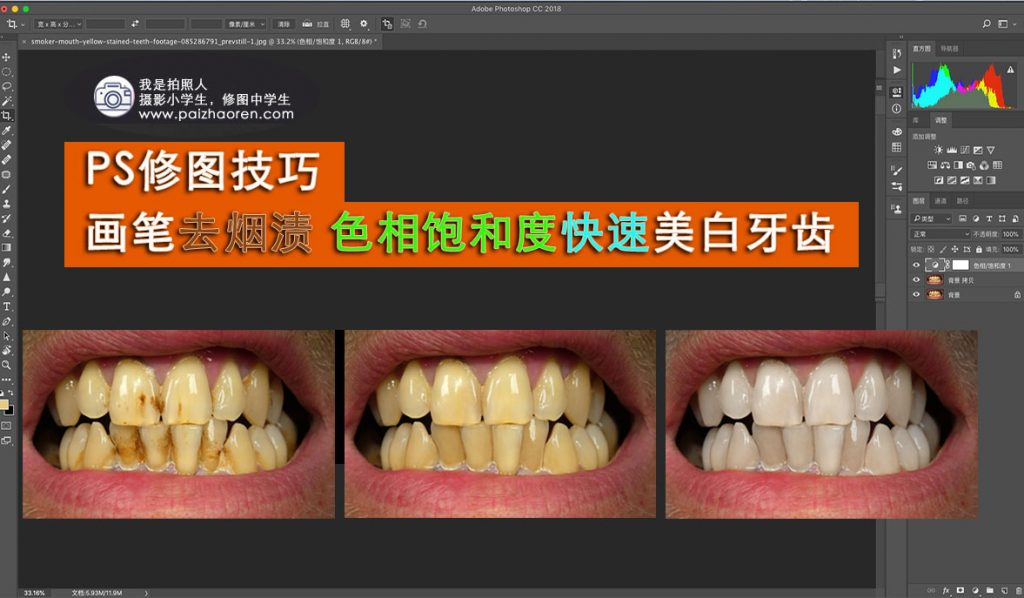 PS修图技巧 利用画笔和色相饱和度工具 去除牙渍 美白牙齿(附素材) PS修图技巧 利用画笔和色相饱和度工具 去除牙渍 美白牙齿(附素材)